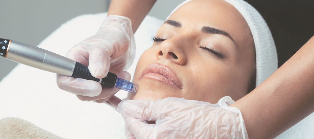 xr:d:DAF5lmy7r4E:29,j:2401960487571950911,t:24011914 Microneedling aarhus skin pen dermapen hudbehandling