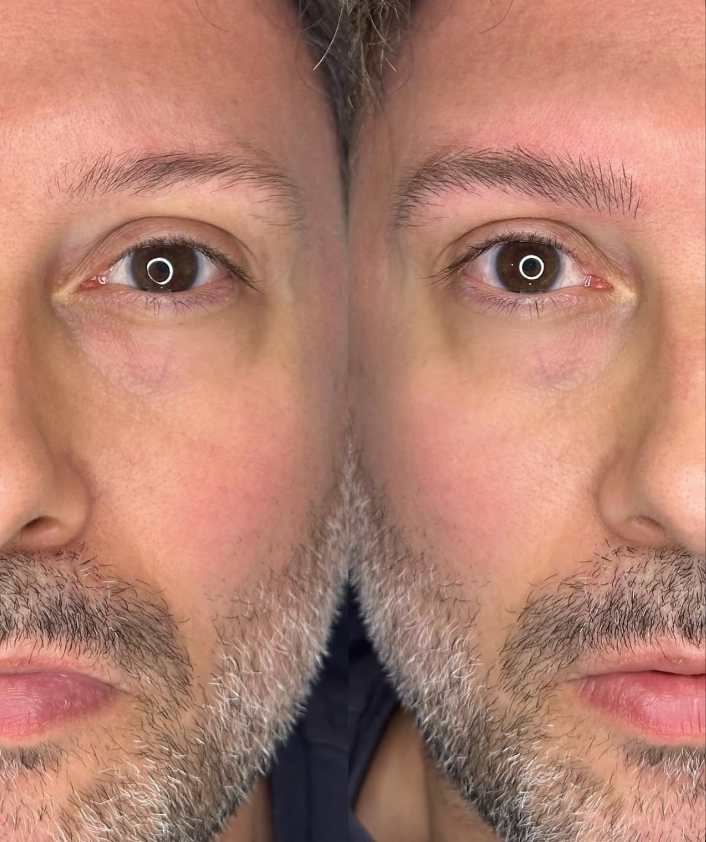 IMG_5126 permanente bryn til mænd aarhus hairstrokes til mænd nano brows men